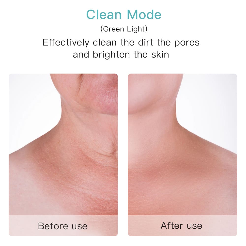 Nettoyant efficace pour les pores du visage ou du cou avant après
